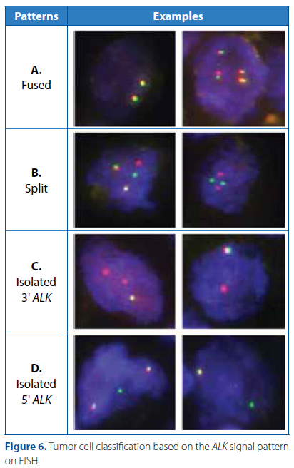 IASLC Atlas of ALK adn ROS1 testing in lung cancer 2e